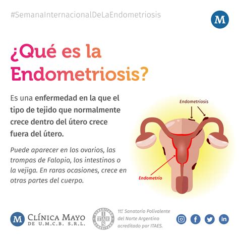 causas de la endometriosis